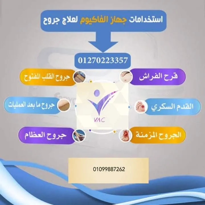 Vip service for home