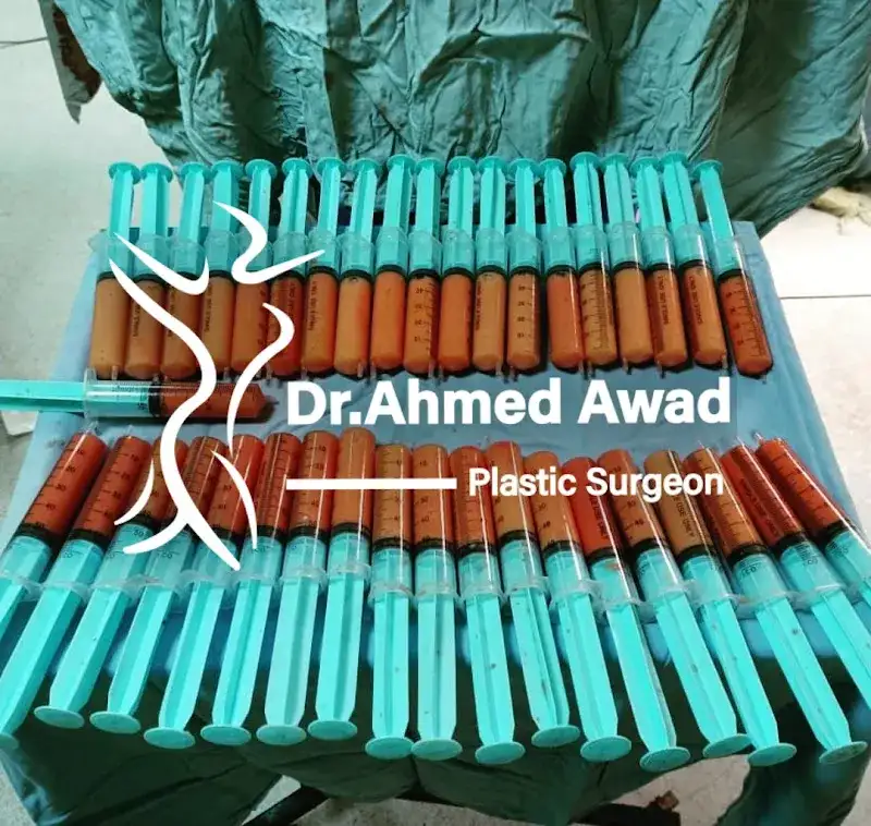د أحمد عوض أخصائي جراحة التجميل والحروق والليزر وزراعة الشعر