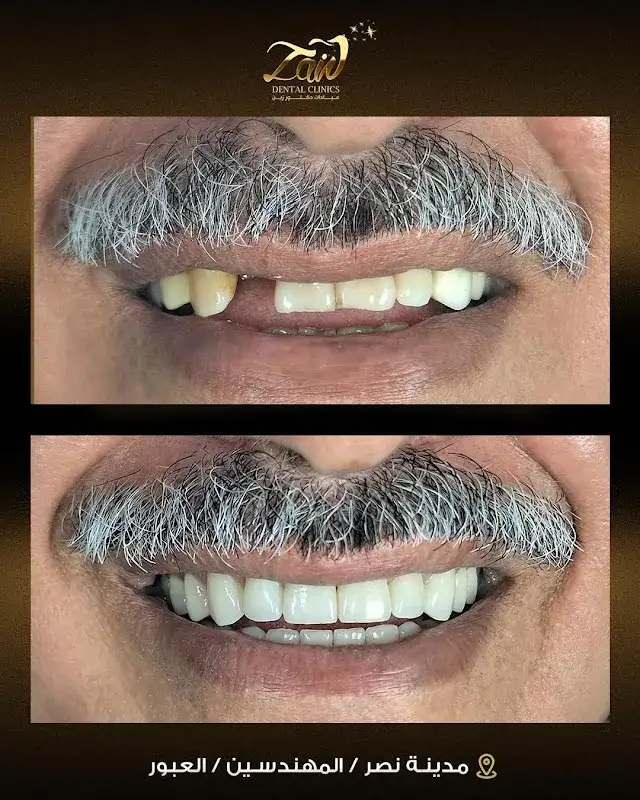 عيادات دكتور زين فرع مدينة نصر