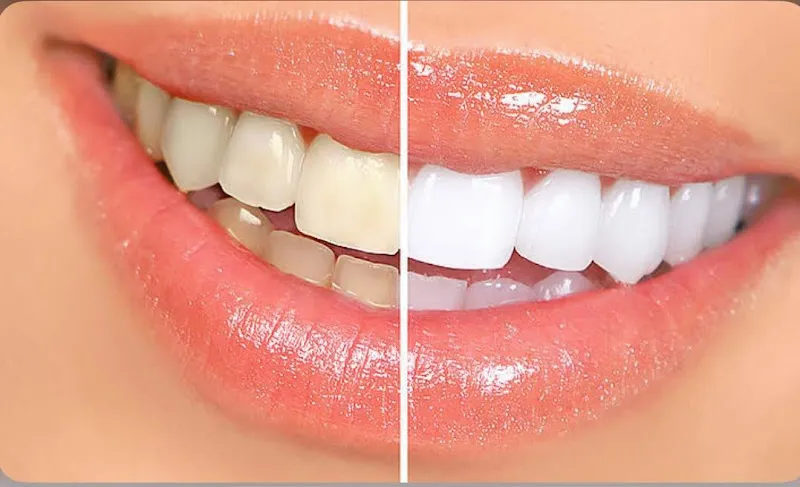 Dr Beshoy Malak Dental Clinic | عيادة أسنان دكتور بيشوي ملاك