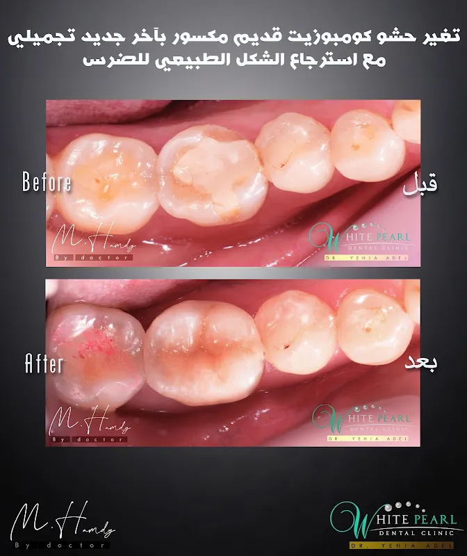 American dental clinic Egypt Dr Ahmed bakry