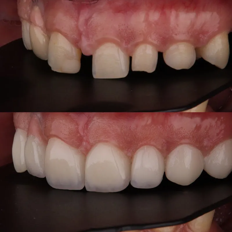 Nabil dental clinic د محمد نبيل فوزي أخصائي جراحه الفم وتجميل وزراعه الاسنان