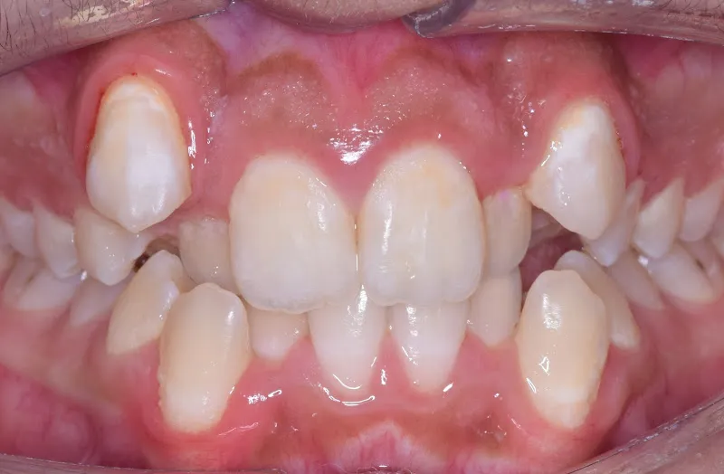 Dr. Mahmoud Attia, Orthodontic Consultant