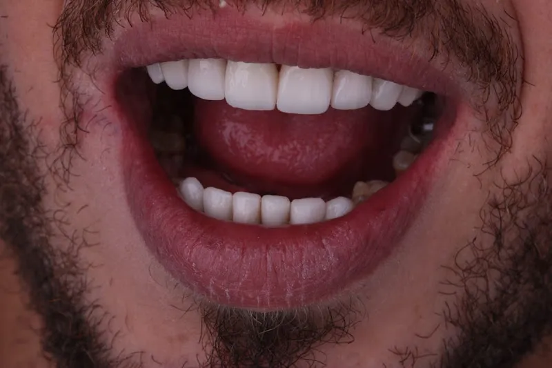 Amr Semary Dental Clinic عيادة دكتور عمرو سمرى لطب و تجميل الأسنان