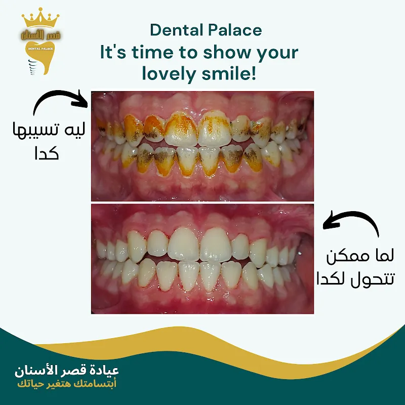 عيادة قصر الأسنان - Dental Palace Clinic