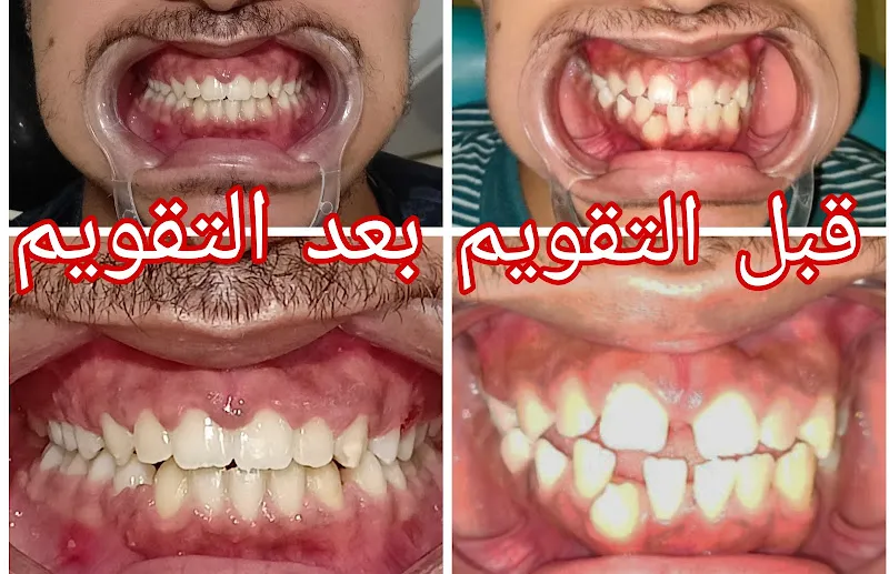 د/احمد علاء خلفه