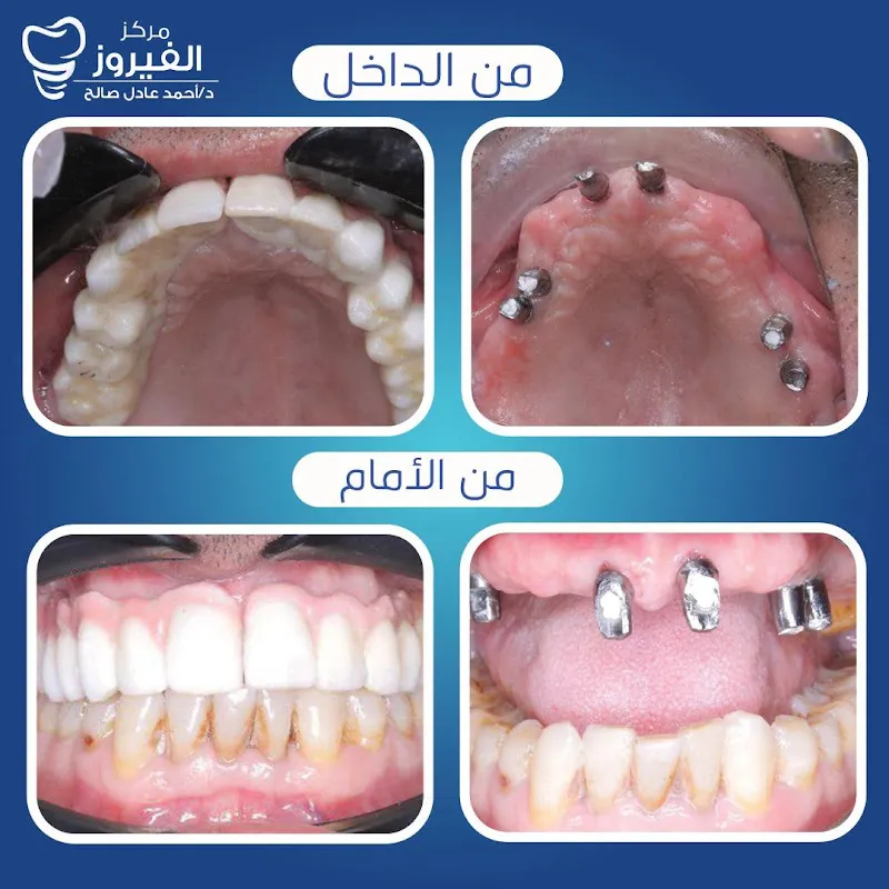 دكتور محمود مرعي لطب وجراحة الفم والاسنان