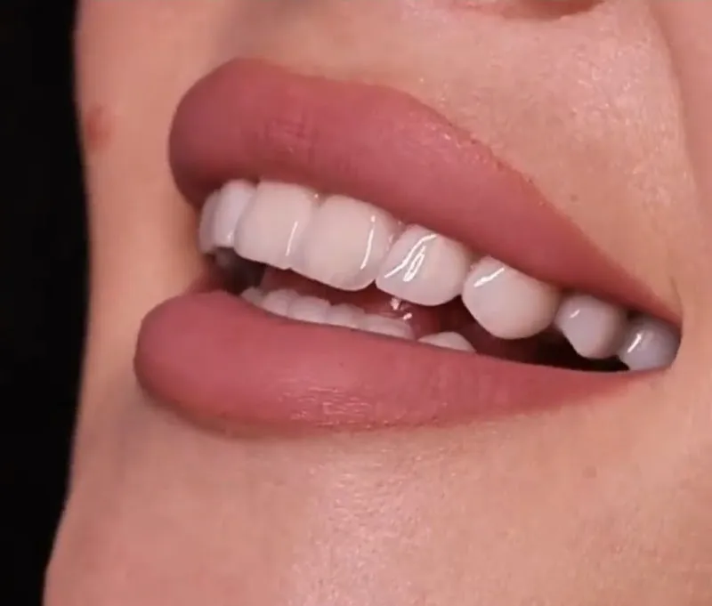 El Dentista ® - Dr. Tarek Abo El Haggag