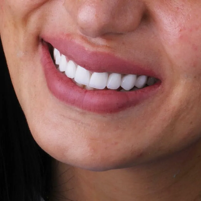مركز د. أسامة أبوزيد لتجميل وزراعة الأسنان (Saudi Clinic)