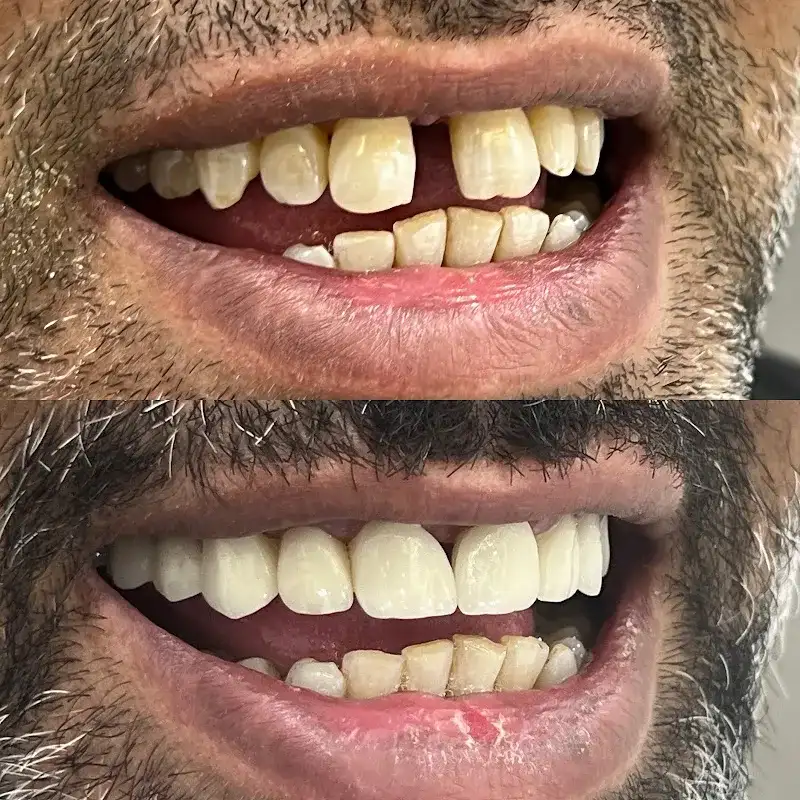 Royalty Dental Clinic عيادات رويالتي لطب الفم وتجميل الاسنان