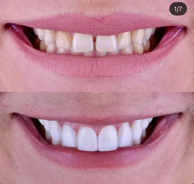 مركز جذور للاسنان بالمنيا