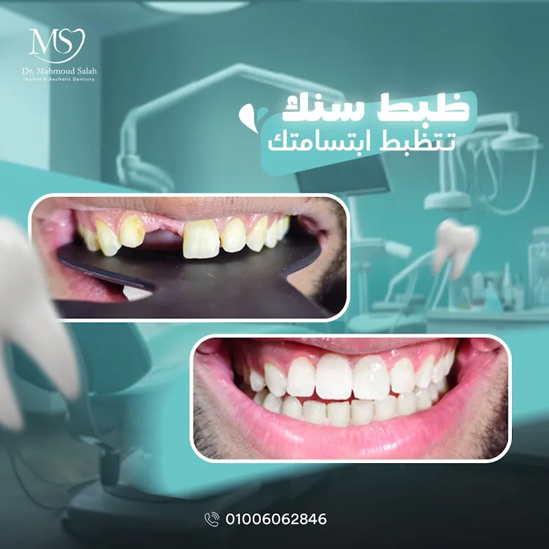 Mahmoud Salah dental clinic عيادة د. محمود صلاح
