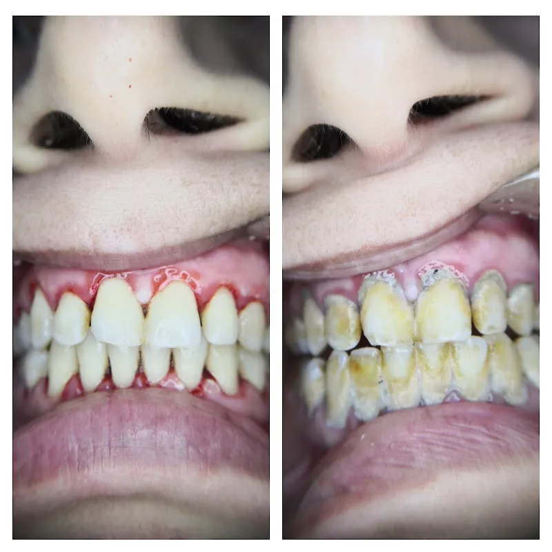 Dr. Walaa Shaaban Abu Al-Ata Dental Clinic and Oral Surgery