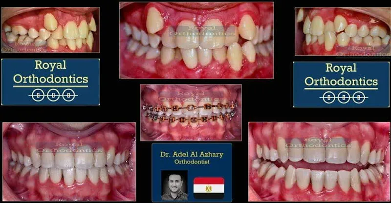 Royal Orthodontics and Implantology Center – Dr. Adel Al Azhary