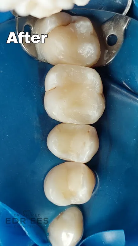 Primadent