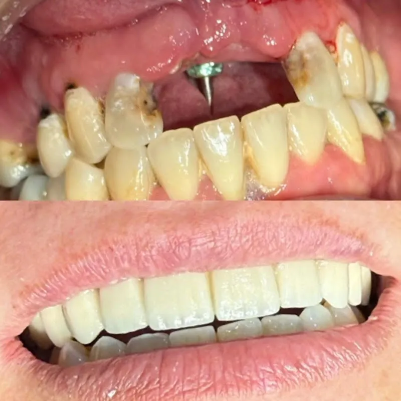 AK Dental Clinic Dr. Diana Raafat
