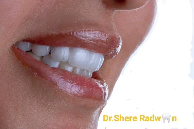 Dr. Sherihan Ahmed Radwan, Consultant in Endodontics and Cosmetic Dentistry, SHEREDENT SMILES SSEDC