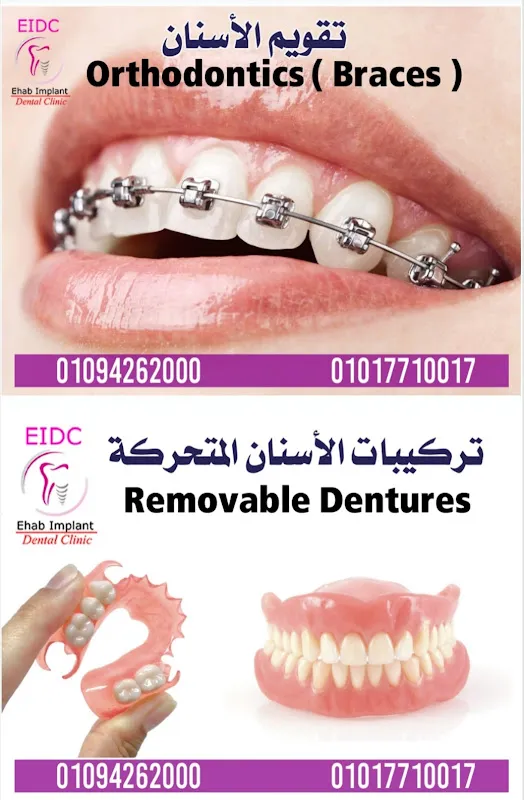 Dr. Mohamed Fawzy Center for Dental Implants and Cosmetic Dentistry
