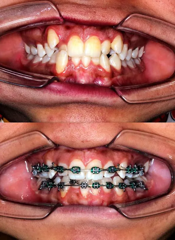 Smily Dental and Orthodontic Clinic - Asyut