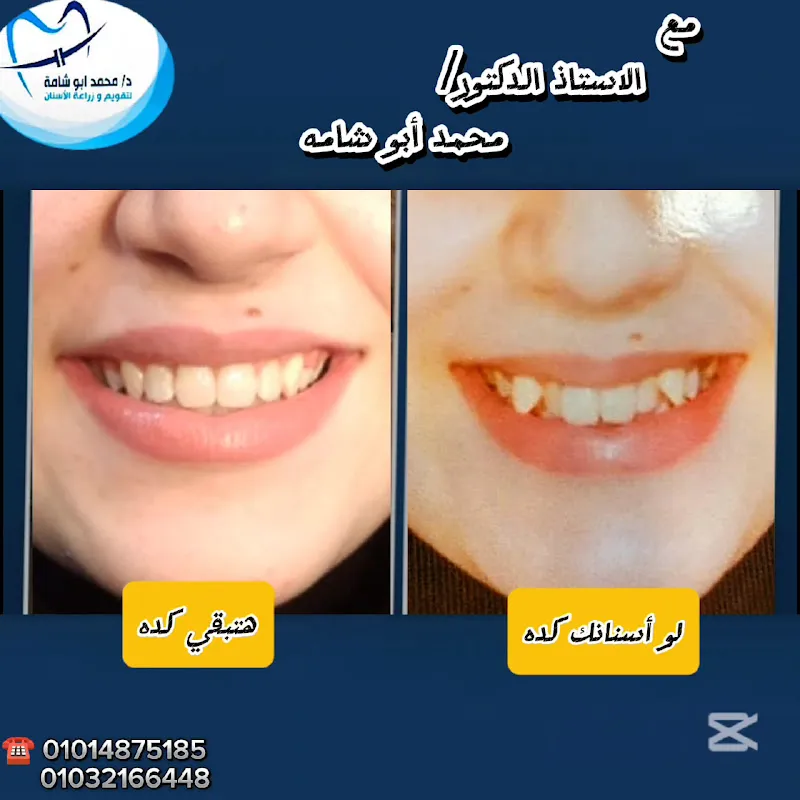 مركز الدكتور محمد ابوشامه لتقويم وزراعه الاسنان