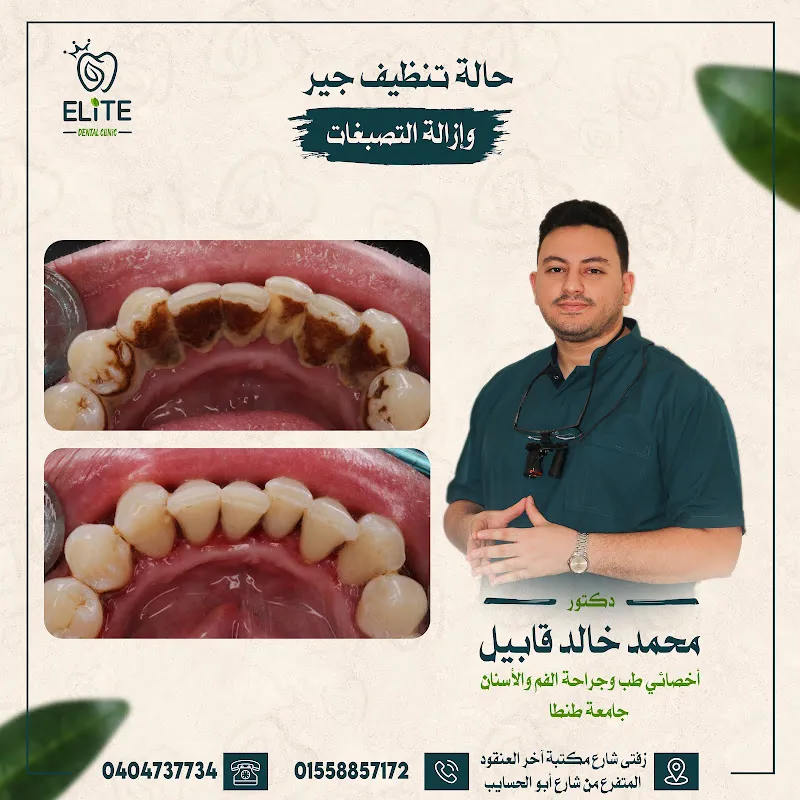 Elite Dental Clinic