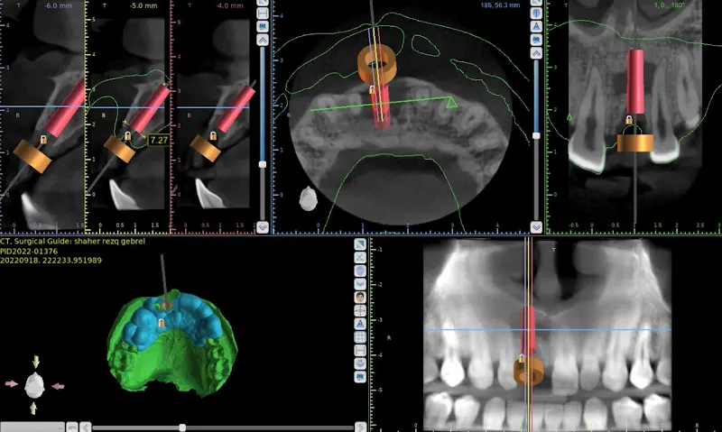 Al-Basma Scan for Dental Digital Solutions