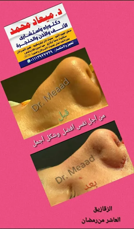 Dr. Mead Mohammad Clinic. Ear, Nose, and Throat (ENT), and Rhinoplasty and Otoplasty.