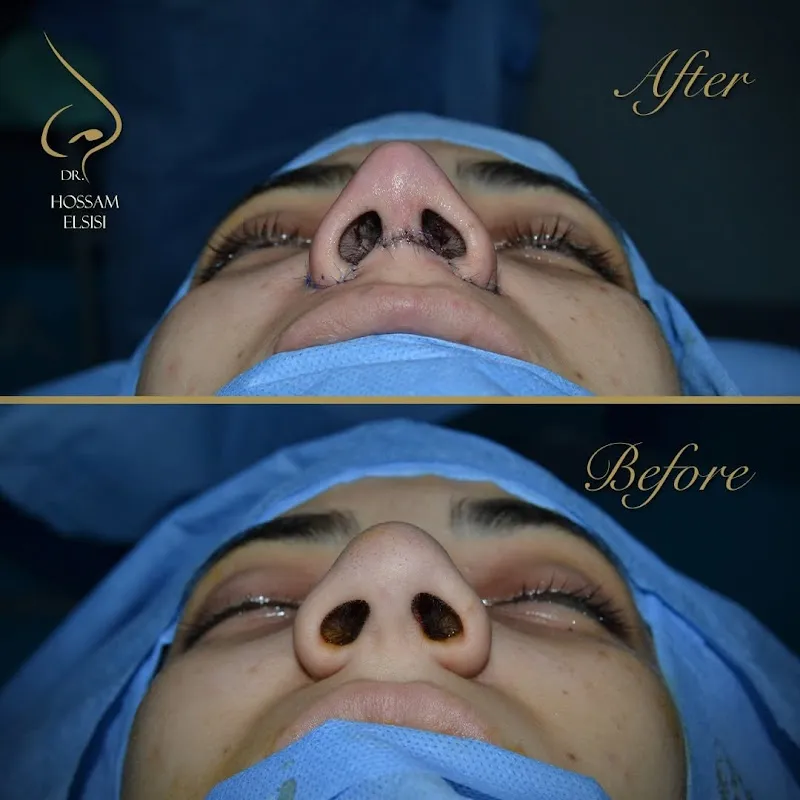 Prof. Dr. Hossam El-Sisi ENT and Nasal Surgery Center, Heliopolis Branch