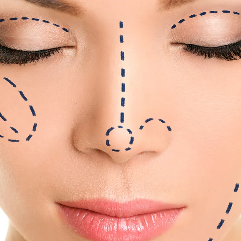 Alfayrouz Plastic Surgery Clinic, Dr. Ayman Alfiky. Body Contouring and Hand Surgery, Faisal.