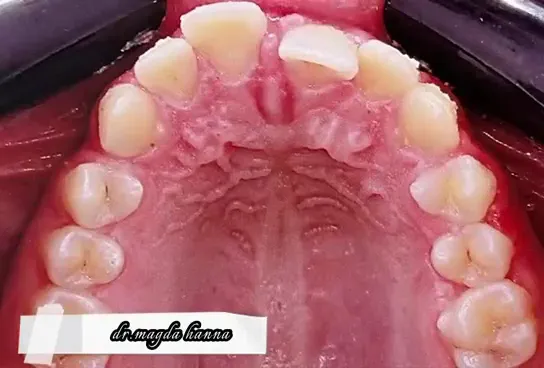 مركز دكتورة ماجدة حنا طب وجراحه الفم والاسنان ( Mego smile ) Dr.Magda Hanna clinic
