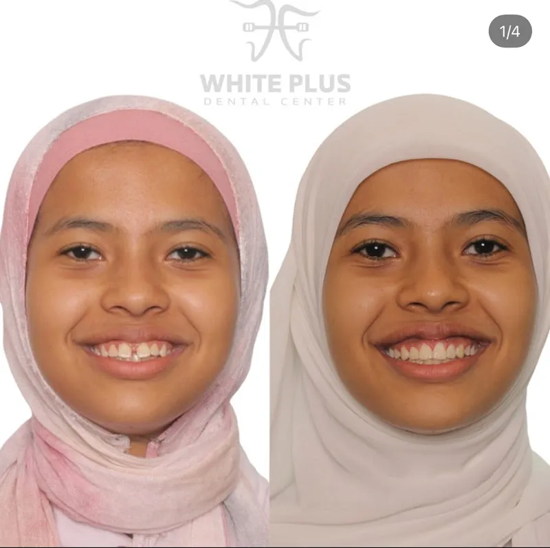 Dr. Abdelrahman Faisal - Dental Care Clinic