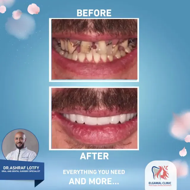 دكتورة هبة حلمى الحديدى