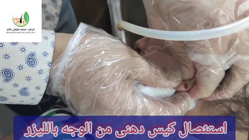 دكتور محمد التركي