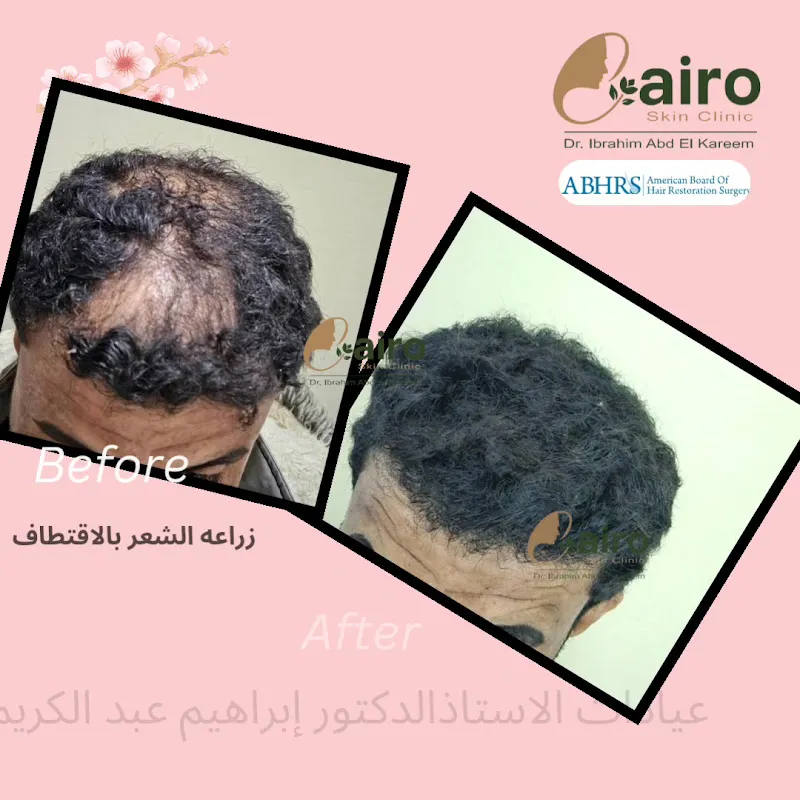 عياده دسوق للامراض الجلديه والليزر - د ابراهيم عبد الكريم