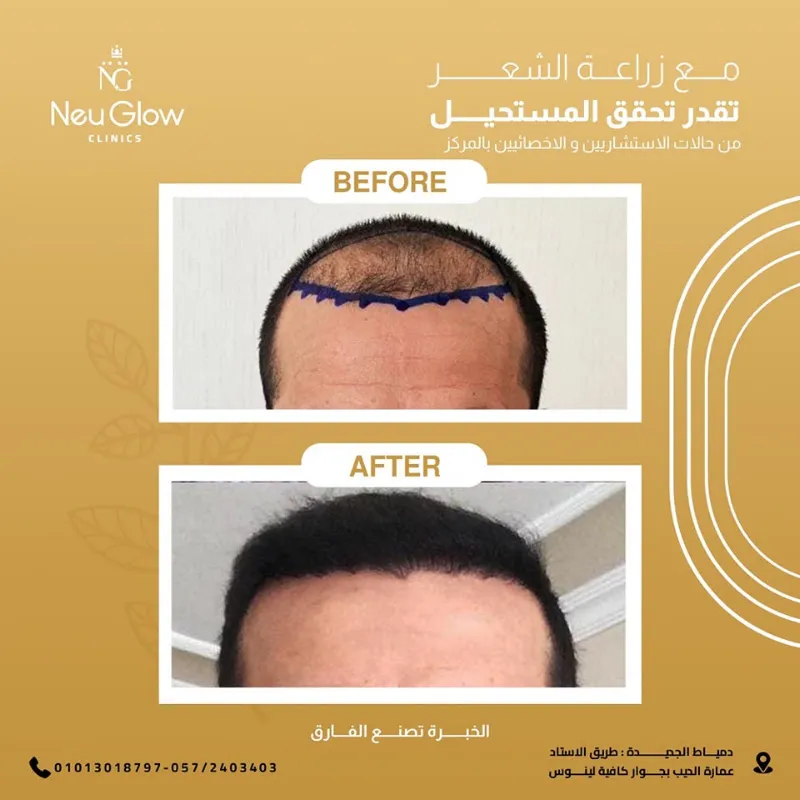 Deltaderm Clinic دلتا ديرم كلينك