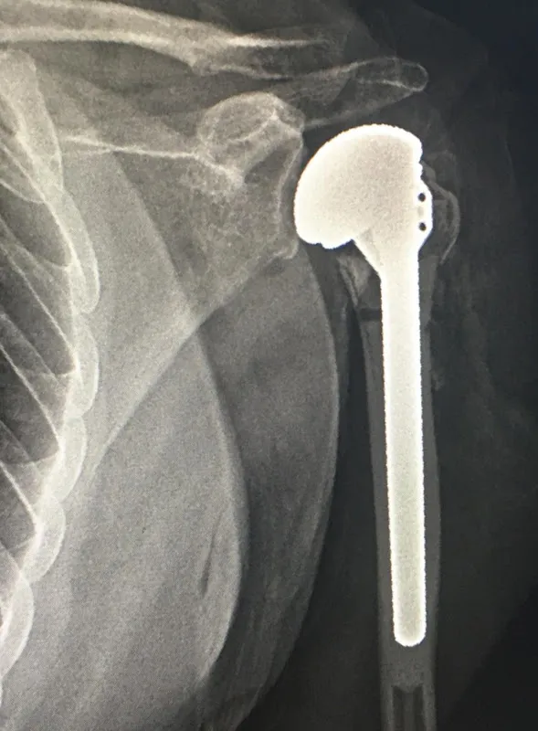 Dr. Mohamed Abou Daoud, Lecturer of Orthopedic and Joint Surgery at the Faculty of Medicine and University Hospitals