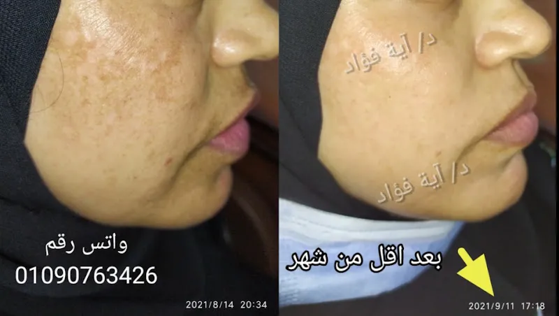 عيادة دكتورة آية فؤاد .. الجلدية والتجميل