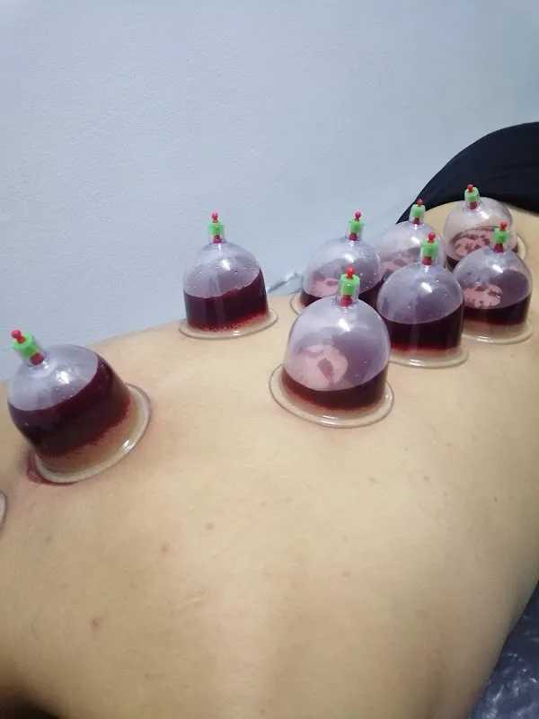 مركز دكتور جهاد سامي الحلوجي للعلاج الطبيعي والتخسيس