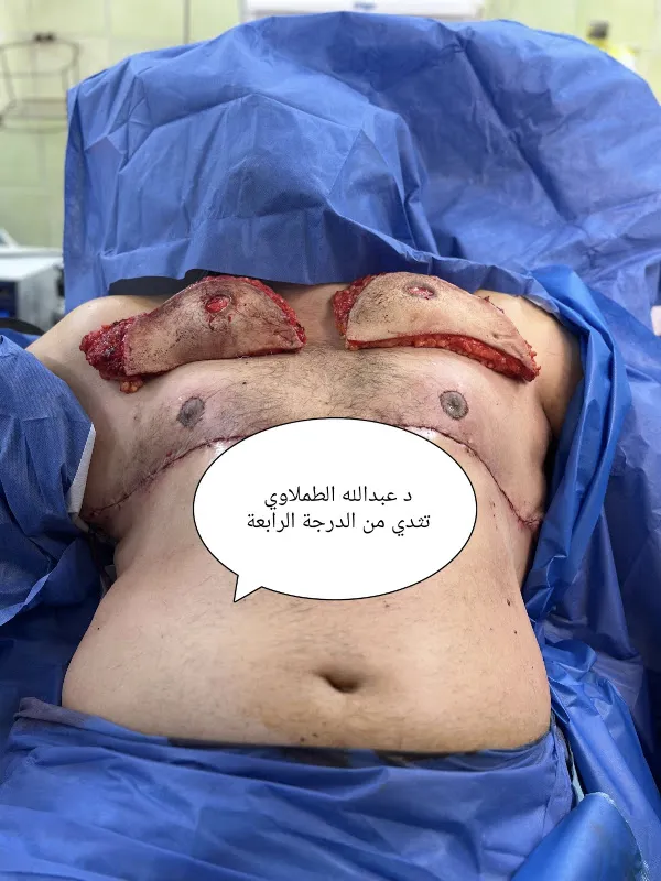 عيادات جراحة التجميل و الحروق دكتور عبدالله الطملاوي