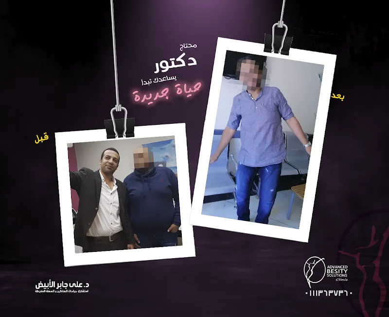 Dr. Ali Gaber Al-Abyad Laparoscopic and Bariatric Surgery Clinic | Menoufia Branch