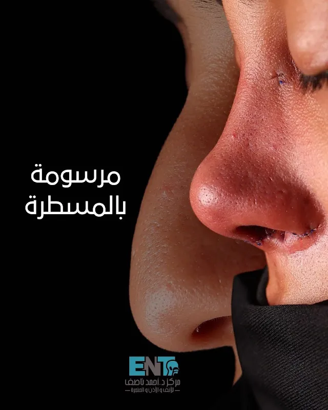 Dr. Ahmed Naseef ENT Center