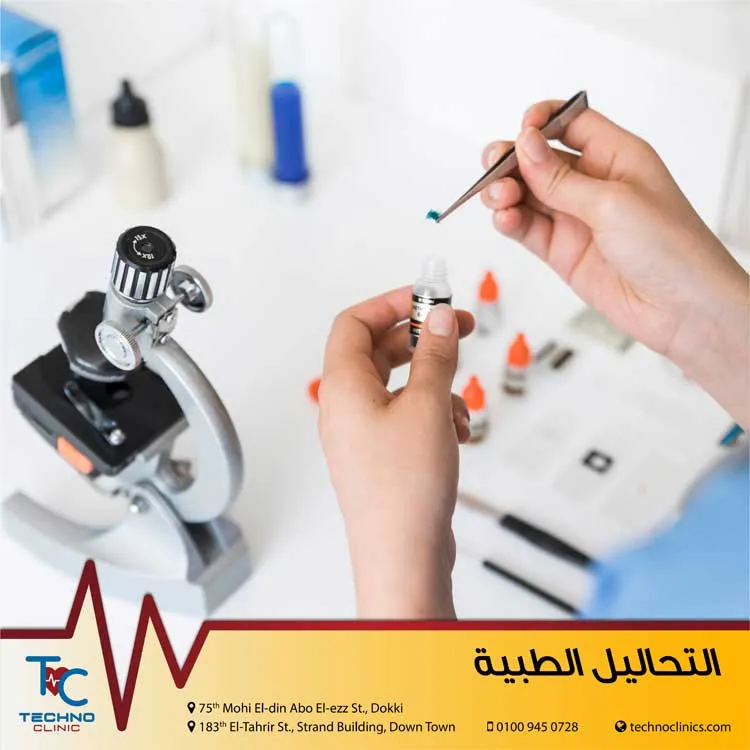 معامل الأميرة
