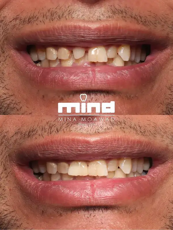 Mina Moawad Dental Clinic- عيادة مينا معوض للأسنان