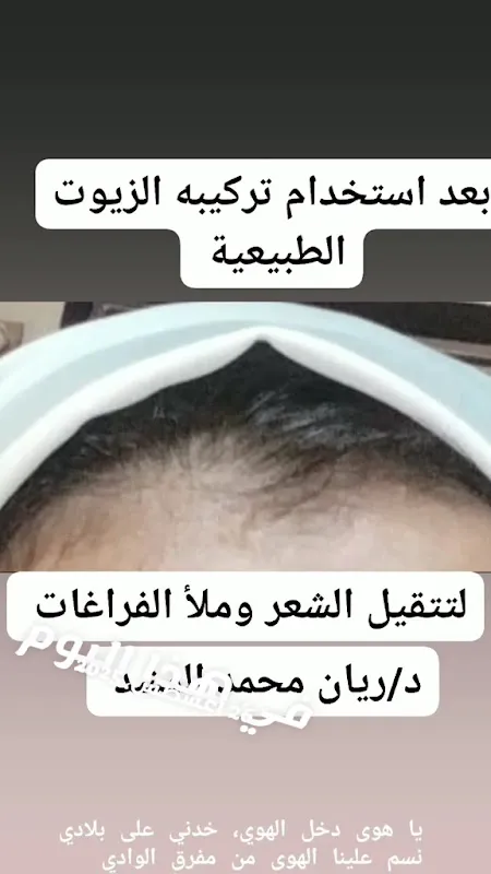 مركز الدكتور ريان لعلاج بالأعشاب الطبيعية و النباتات الطبية و العسل