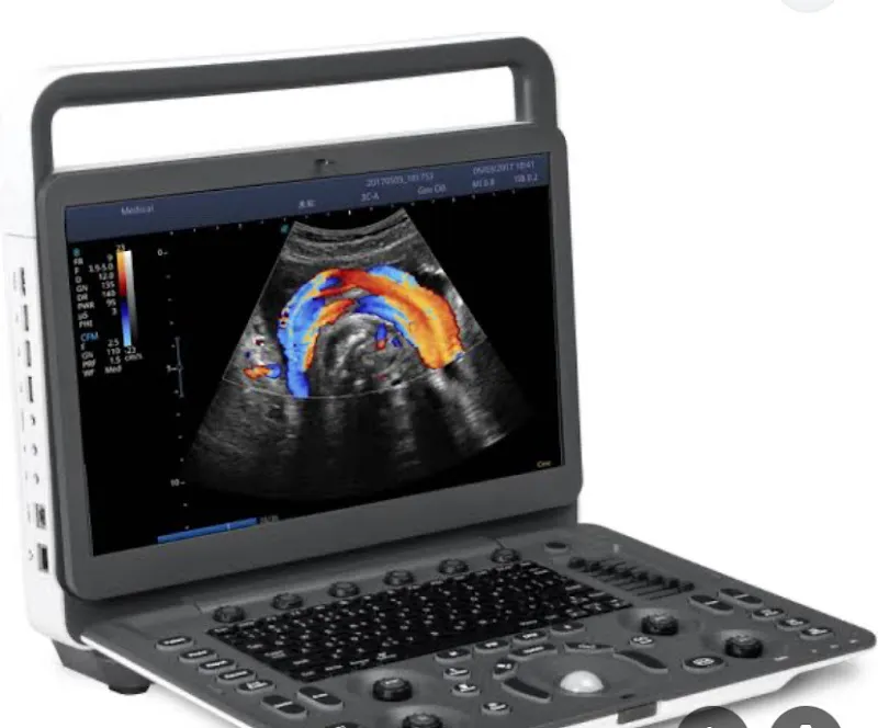 Dr. Osama El-Hindawy Clinic, Consultant in Internal Medicine, Cardiology and Vascular Diseases, Echocardiography