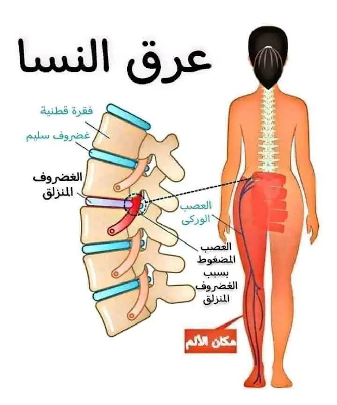 مركز سلامتك للعلاج الطبيعي دكتور أسامة عادل على