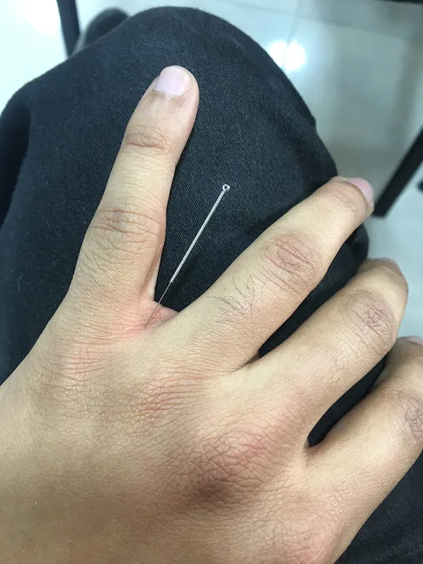مركز سبح الله للعلاج الطبيعي والتأهيل الحركي والحجامة