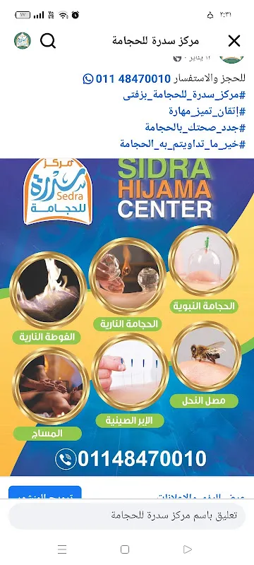 مركز سدرة للحجامة