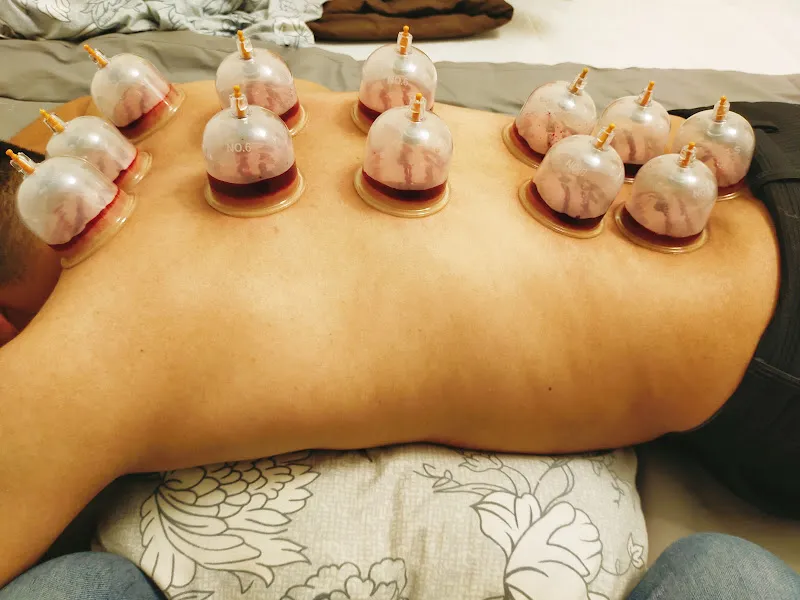 In-home physiotherapy, in-home cupping therapy, in-home massage, and Ruqyah Shariah (spiritual healing) – Home visit services for physiotherapy, cuppi