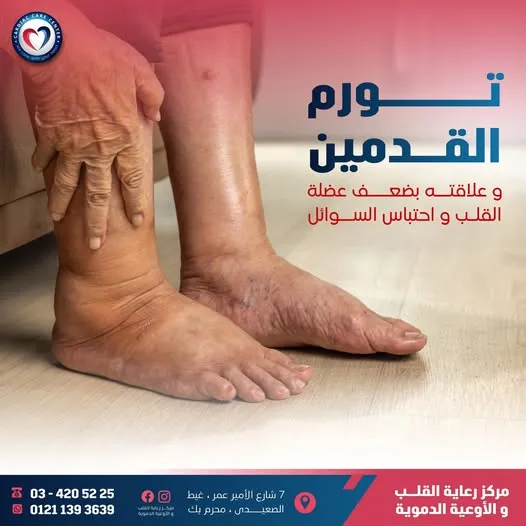 مركز رعاية القلب و الأوعية الدموية الحديث